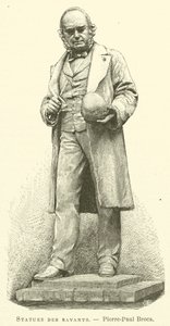 Statues des savants, Pierre-Paul Broca - French School