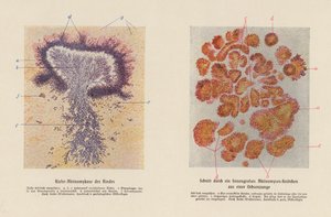 Actinomyces bovis - German School