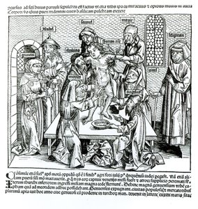 Circoncision, de 