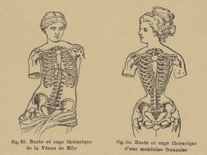 Comparaison de la forme de la poitrine et de la cage thoracique de la Vénus de Milo avec celle d