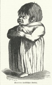 Crétin, femme souffrant de carence congénitale en iode (gravure) - German School