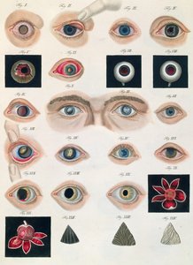 Description des anomalies congénitales de l