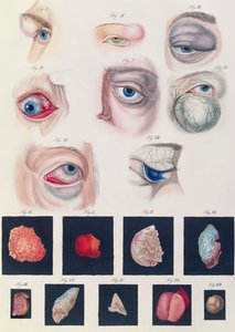 Description des anomalies congénitales de l