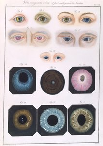 Description des anomalies congénitales de l
