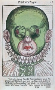 Masque pour traiter un strabisme, de l