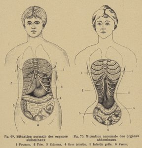 Situation normale des organes internes de l
