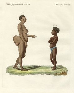 Variétés humaines étranges