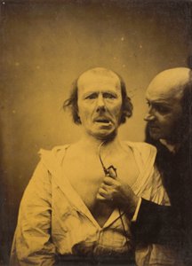 Cette contraction de m. platysma seule manque d