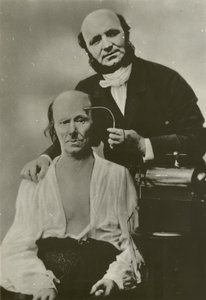Neurologue français Duchenne de Boulogne utilisant son appareil d