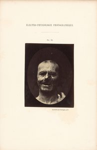 Électro-Physiologie Photographique, Figure 53 - Guillaume Benjamin Duchenne