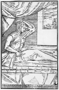 Chirurgie reconstructive du nez, illustration de De curtorum chirurgia per insitionem par Gaspare Tagliacozzi (1545-99) Venise, publié en 1597