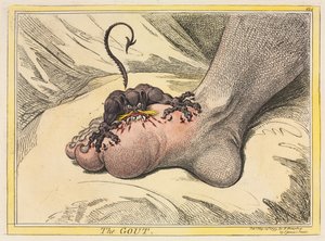 La goutte - James Gillray