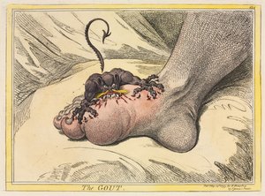 La Goutte, 1799 - James Gillray