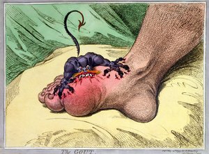 La goutte, publié par Hannah Humphrey en 1799