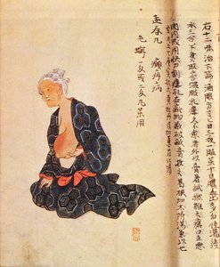 Le premier traitement chirurgical du cancer du sein sous anesthésie générale par Seishu Hanaoka en 1804 - Japanese School