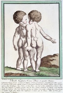 Enfants siamois - dans "Les déviations de la nature" par Régnault
