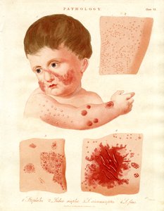 Maladies pathologiques de la peau - John Pass