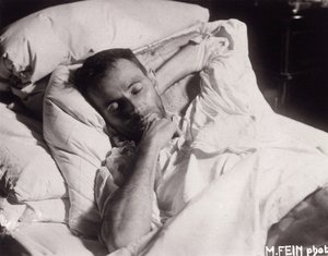 Egon Schiele sur son lit de mort, 1918 - Martha Fein