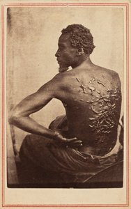 Le dos flagellé,v. 1863 (photo) - McPherson & Oliver