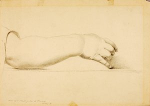 Bras de l