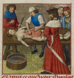 Néron regardant sa mère Agrippine se faire disséquer, illustration du 