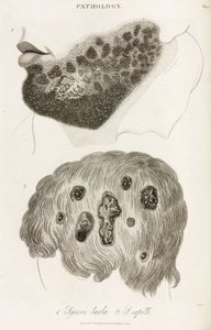 Dermatologie Maladies de la peau - John Pardon