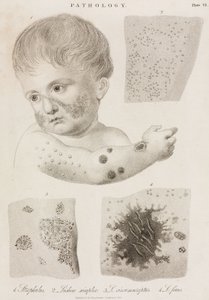 Dermatologie Types de maladies de la peau - John Pardon