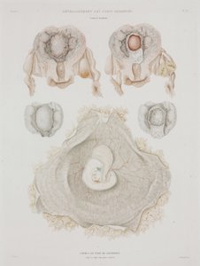 Gynécologie Utérus humain avec embryon, vers 1847-1859 - John Pardon