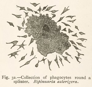 Dessin par Elie Metchnikoff de cellules phagocytaires entourant une particule étrangère