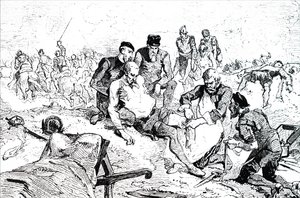 Ambroise Paré ligaturant des artères après amputation