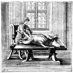 Transfusion de sang animal à humain, 1679