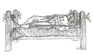 Appareil pour réduire les dislocations, 1544 - Unbekannt