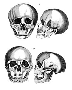 Comparaison des crânes germaniques et africains, début du XIXe siècle