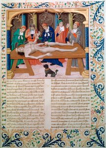 Dissection, fin du 15ème siècle - Unbekannt