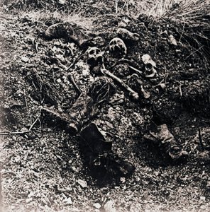 Restes humains, vers 1914-1918 - Unbekannt