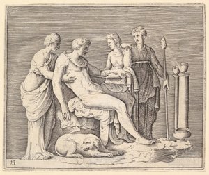 Homme assisté par trois femmes - Unbekannt