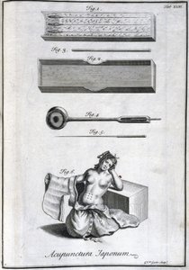 Médecine alternative : planche représentant les aiguilles d