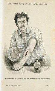 Peindre une plaie avec une solution antiseptique, vers 1890