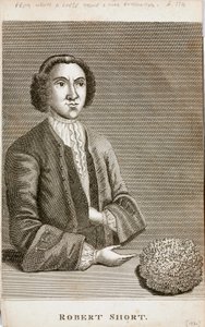 Robert Short, curiosité médicale, vers 1750 - Unbekannt