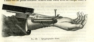 Sphygmographe direct - Unbekannter Künstler