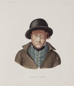Maladies, Lèpre Lépreux mâle, Islande, début 19e siècle