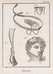 Dispositifs chirurgicaux pour les oreilles, le nez et la gorge - Unbekannt