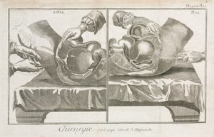 Équipement, chirurgie abdominale de l