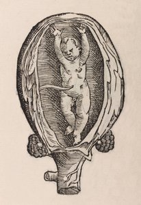 Partus non naturalis manibus funra canut porrectie - Unbekannt