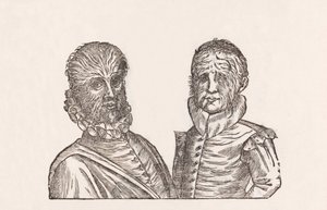 Pater annorum quadragina, & filus annorum viginti toto corpore pilosi - Unbekannt