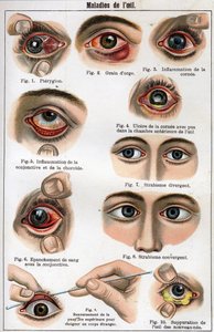 Maladies de l