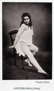 Hystéro-épilepsie - Contracture dans « Iconographie photographique de la Salpêtrière : service de M. Charcot » par Paul Regnard et Bourneville - Unknown artist