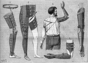 Appareils modernes pour amputés. 1) jambe artificielle avec ceinture, 2) appareil pour désarticuler la cuisse, 3 et 4 bras artificiels inventés et construits par M.L Matthieu pour le défunt Roger, 5) bras artificiel avec main, pouce et index. Dans "La natu