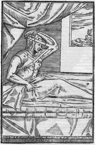 Chirurgie du nez : Chirurgie reconstructive du nez dans « De curtorum chirurgia per insitionem ». Venise