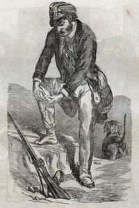 Rage - traitement des morsures faites par un animal enragé - blessé pressant sa plaie - gravure dans "La Santé Universelle - Guide Médical des Familles" 1852 - Unknown artist